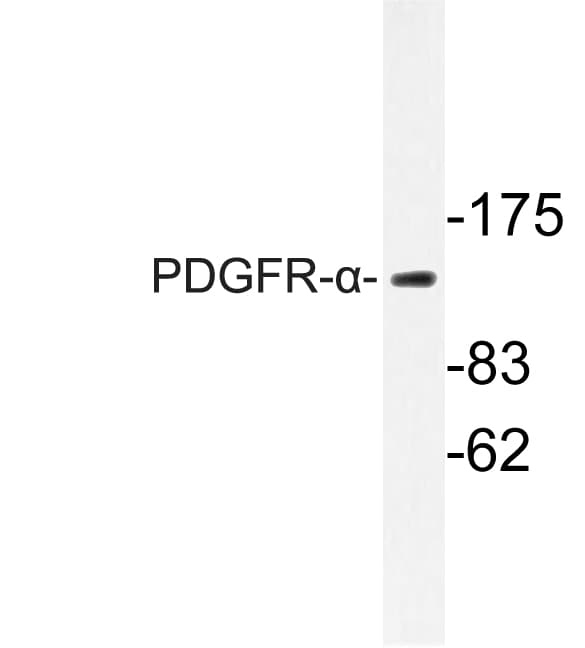 PDGFRA / PDGFR Alpha Antibody (Ser1057)