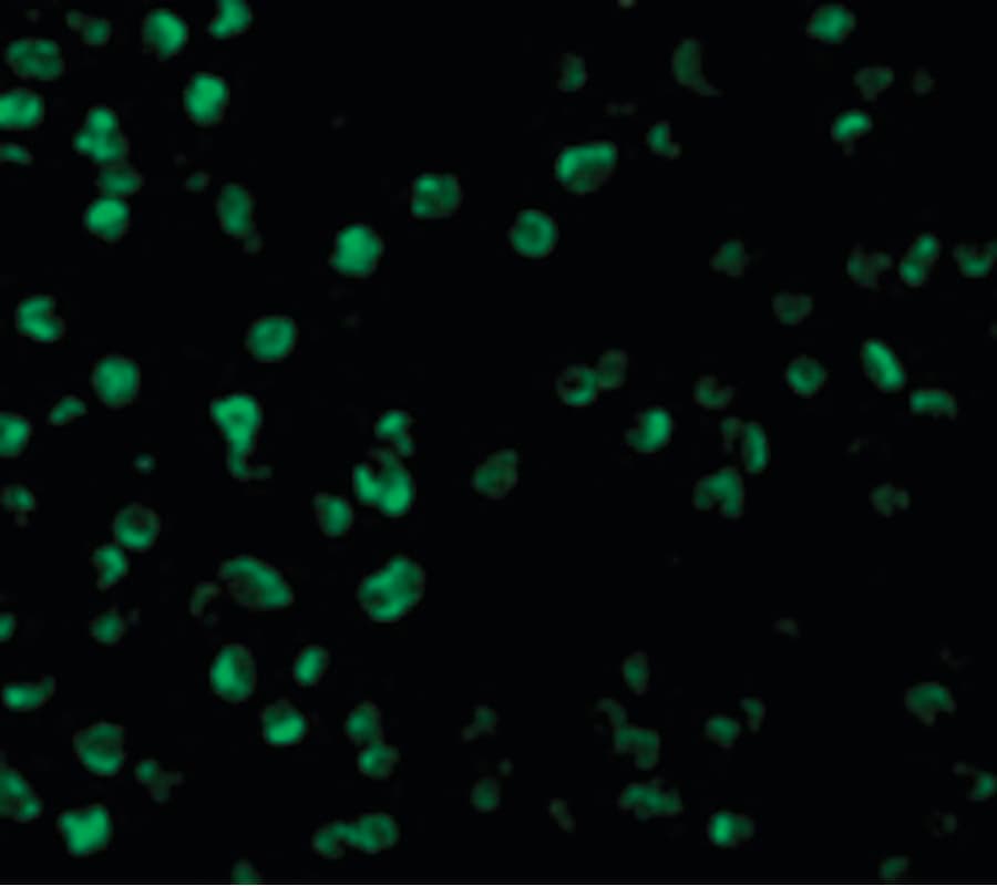 SARM1 / SARM Antibody
