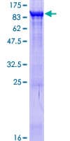 Human COL4A3BP / CERT Protein (Recombinant GST)