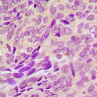 RAB41 Antibody (Internal)