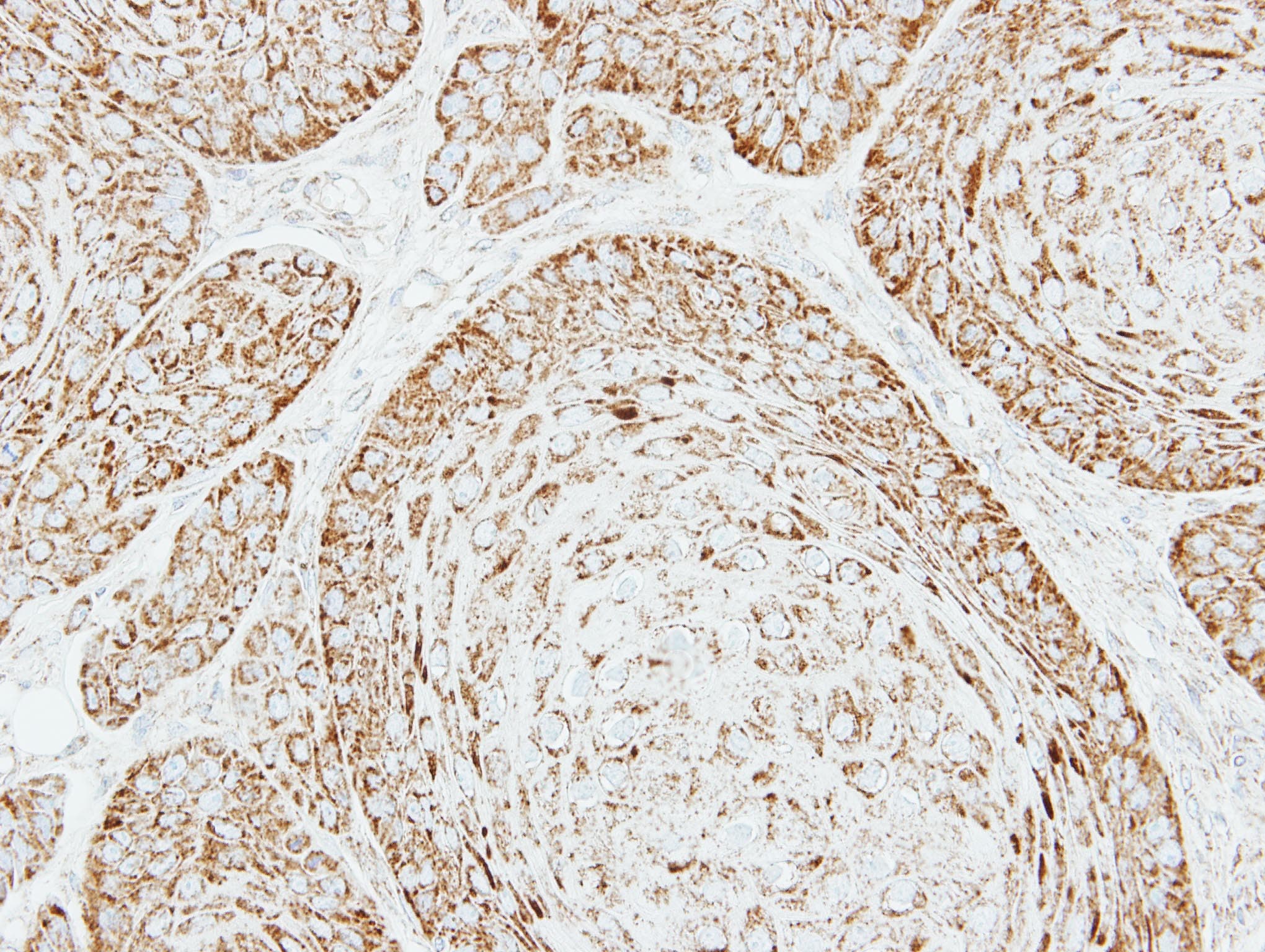 VDAC1 / PORIN Antibody (aa1-211)