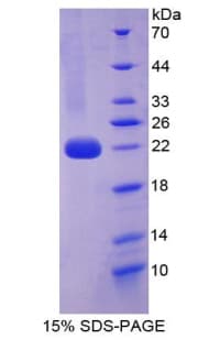 Mouse IL1A / IL-1 Alpha Protein (Recombinant His-T7)