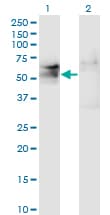 Monoclonal Mouse anti-Human TSPYL1 Antibody (clone 4F11, IF, WB)
