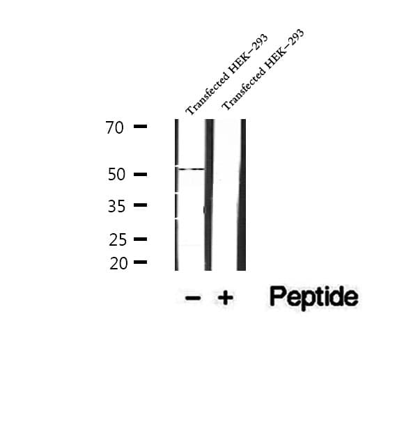 Polyclonal Rabbit anti-Human SRPX2 Antibody (IHC, IF, WB)