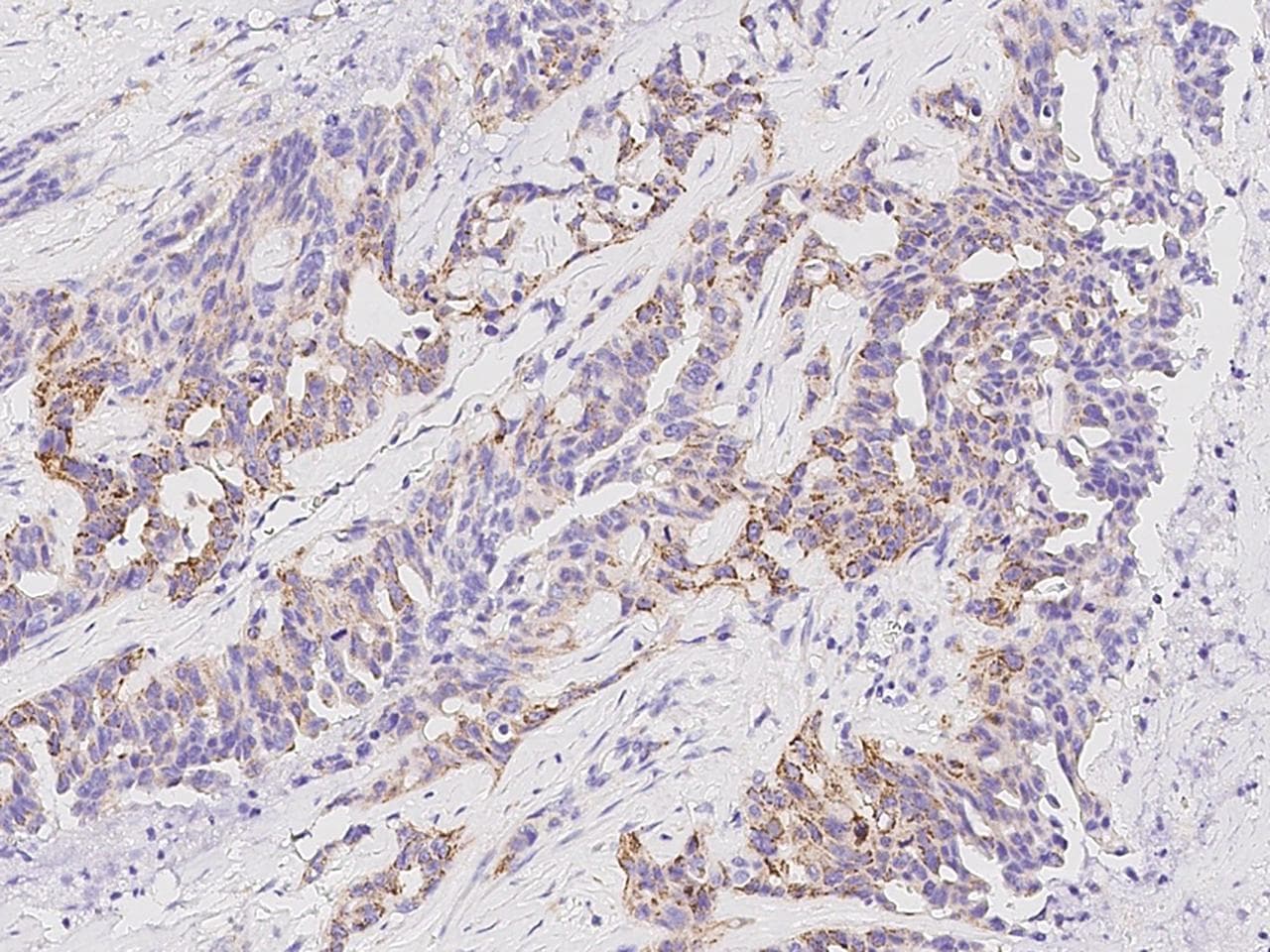 Polyclonal Rabbit anti-Human TRAP1 / HSP75 Antibody (Preservative Free, IHC)