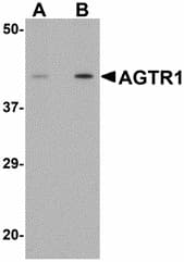 IHC-plus™ AGTR1 / AT1 Receptor Antibody
