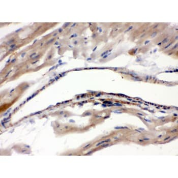 Polyclonal Rabbit anti-Human MAOA / Monoamine Oxidase Antibody (aa457-493, IHC, WB)