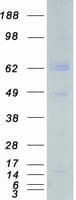 Human ARMS2 Protein (Recombinant Myc-DDK (Flag))