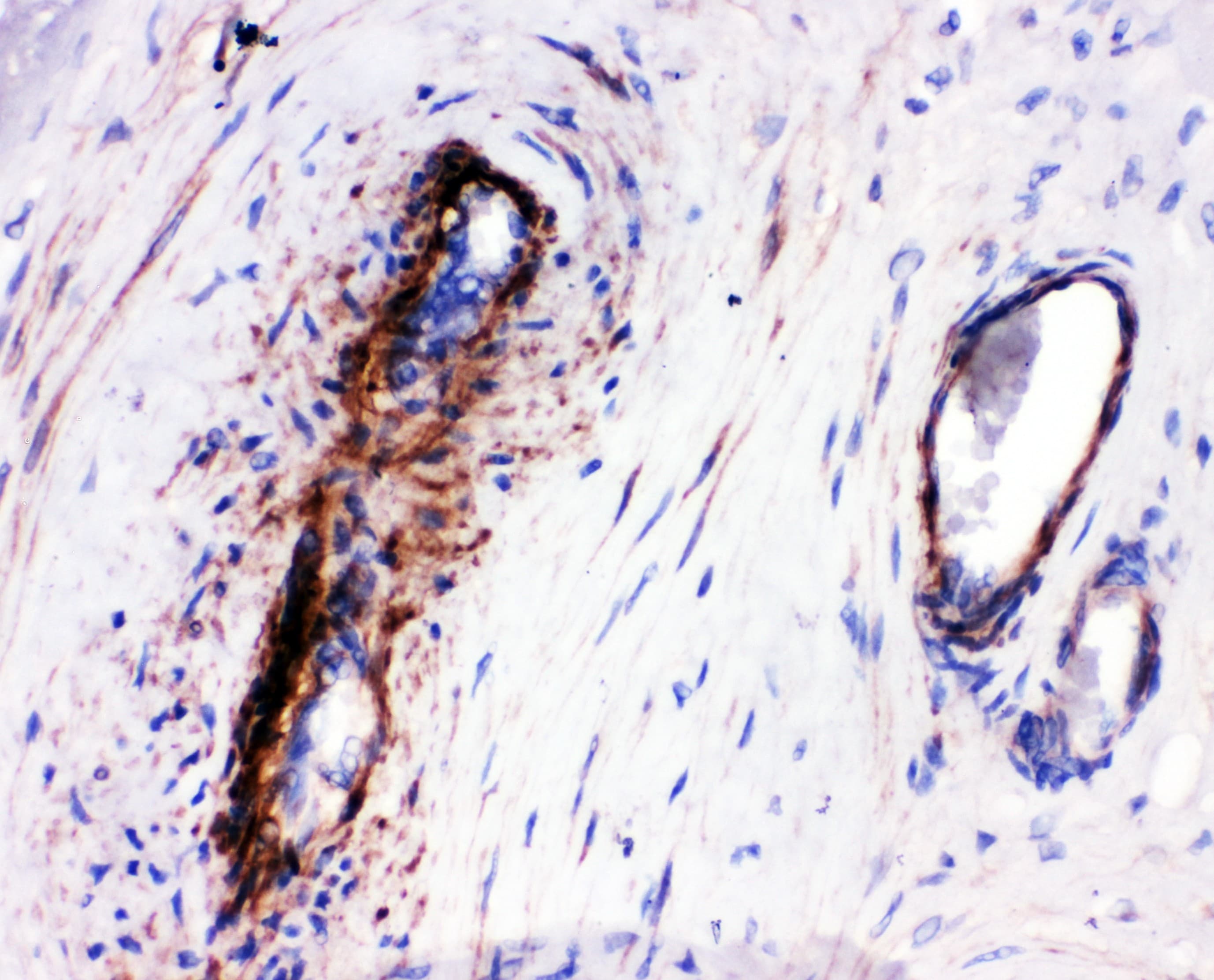 Polyclonal Rabbit anti-Human LASP1 Antibody (aa152-168, IHC, WB)