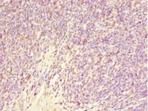 GABRR1 / GABA(A) Receptor rho- Antibody