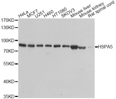 Polyclonal Rabbit anti-Human HSPA5 / GRP78 / BiP Antibody (WB)