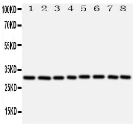 VDAC1 / PORIN Antibody (aa163-178)