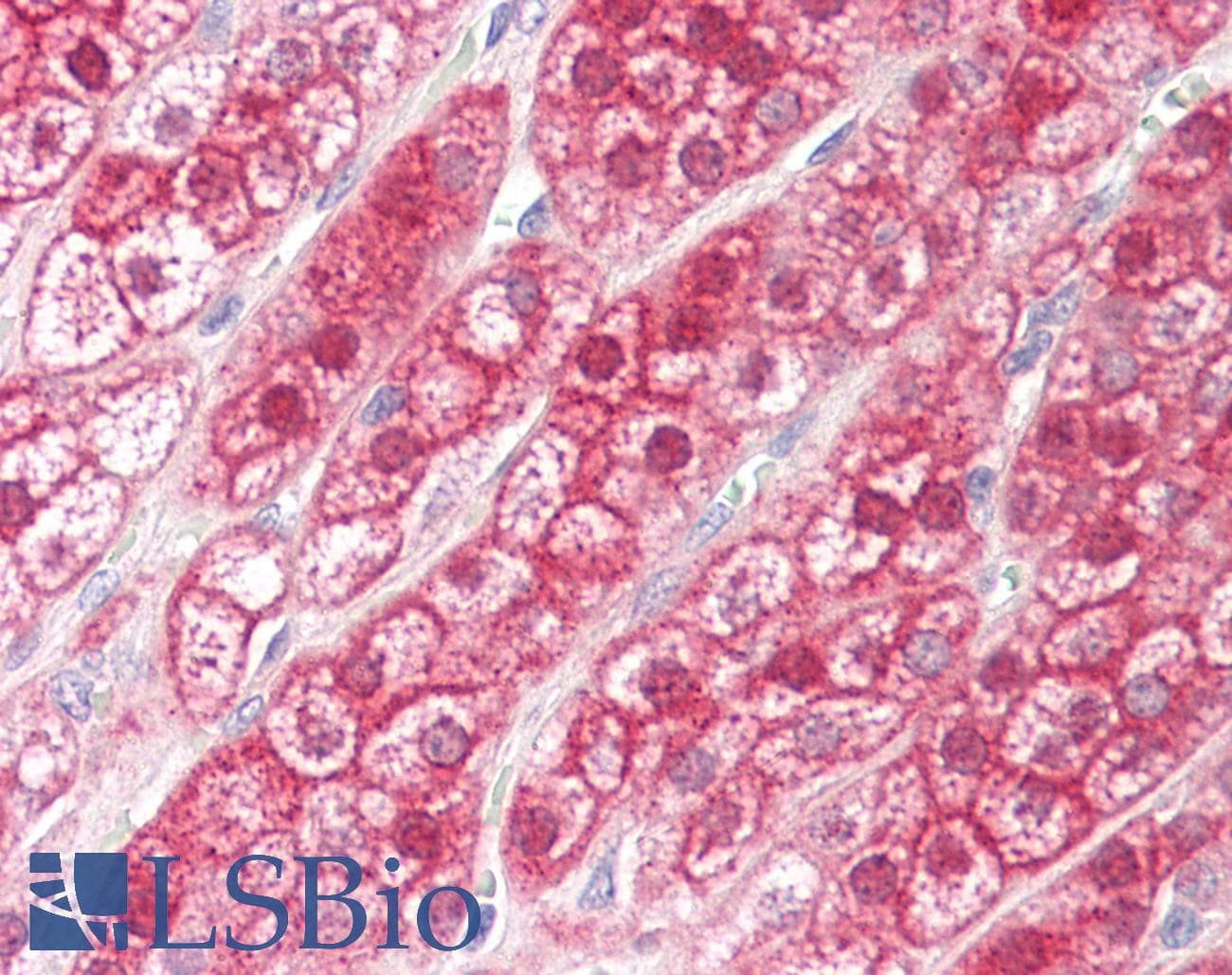 IHC-plus™ NKX2-6 Antibody