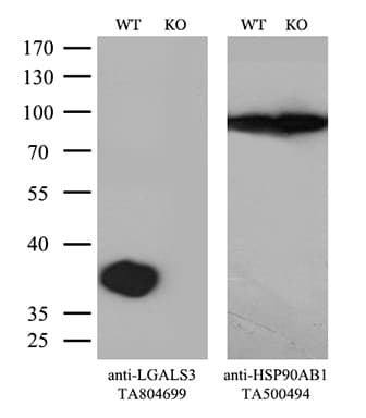 LGALS3 / Galectin 3 Antibody (clone OTI8E3)