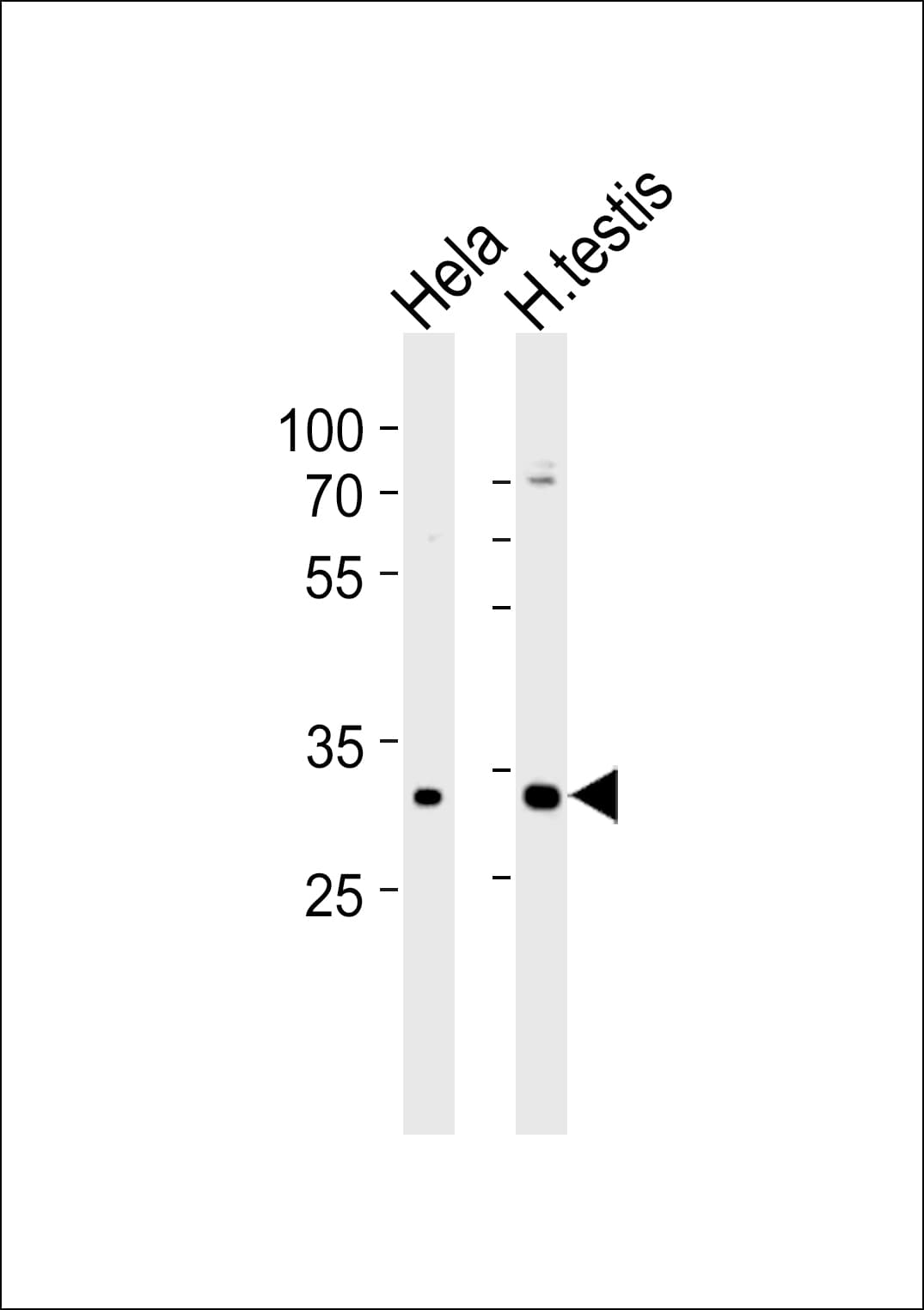 MTX2 Antibody (aa102-126)