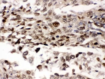 PRKAB2 / AMPK Beta 2 Antibody