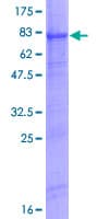 Human WIPI2 Protein (Recombinant GST)