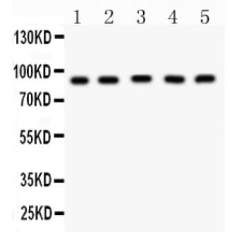 CPT1B Antibody (aa197-226)