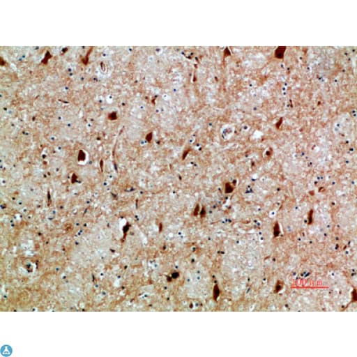 NFAT5 Antibody