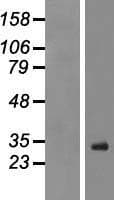 RSPO1 / RSPO Protein (Over-Expression Lysate Myc-DDK (Flag))