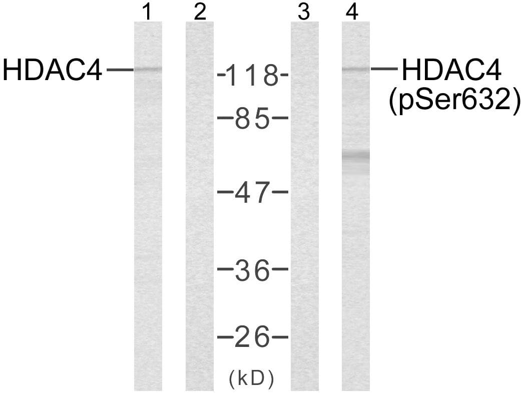 Polyclonal Rabbit anti-Human HDAC4 Antibody (phospho-Ser632, WB)