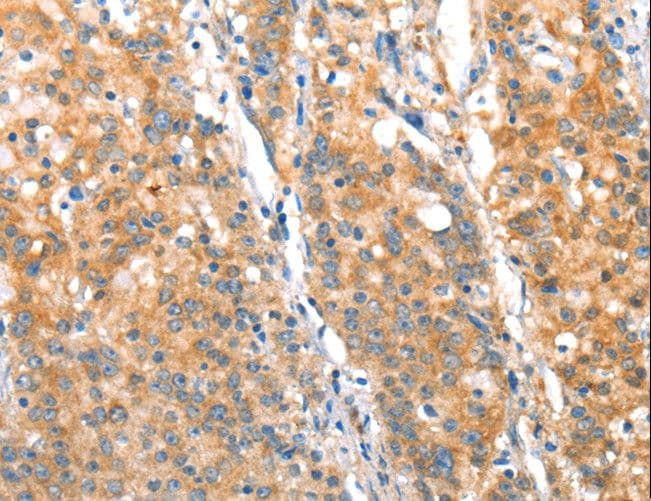 ST14 / Matriptase Antibody