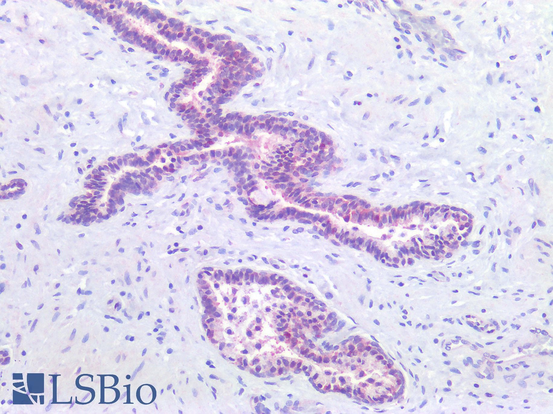 IHC-plus™ PARP1 Antibody