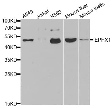 Polyclonal Rabbit anti-Human EPHX1 / Epoxide Hydrolase 1 Antibody (IHC, IF, WB)