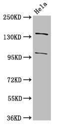 NPC / NPC1 Antibody