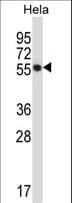 Polyclonal Rabbit anti-Human c-Src Kinase / CSK Antibody (aa33-61, WB)