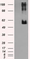 LIPG / Endothelial Lipase Antibody (clone OTI1B8)