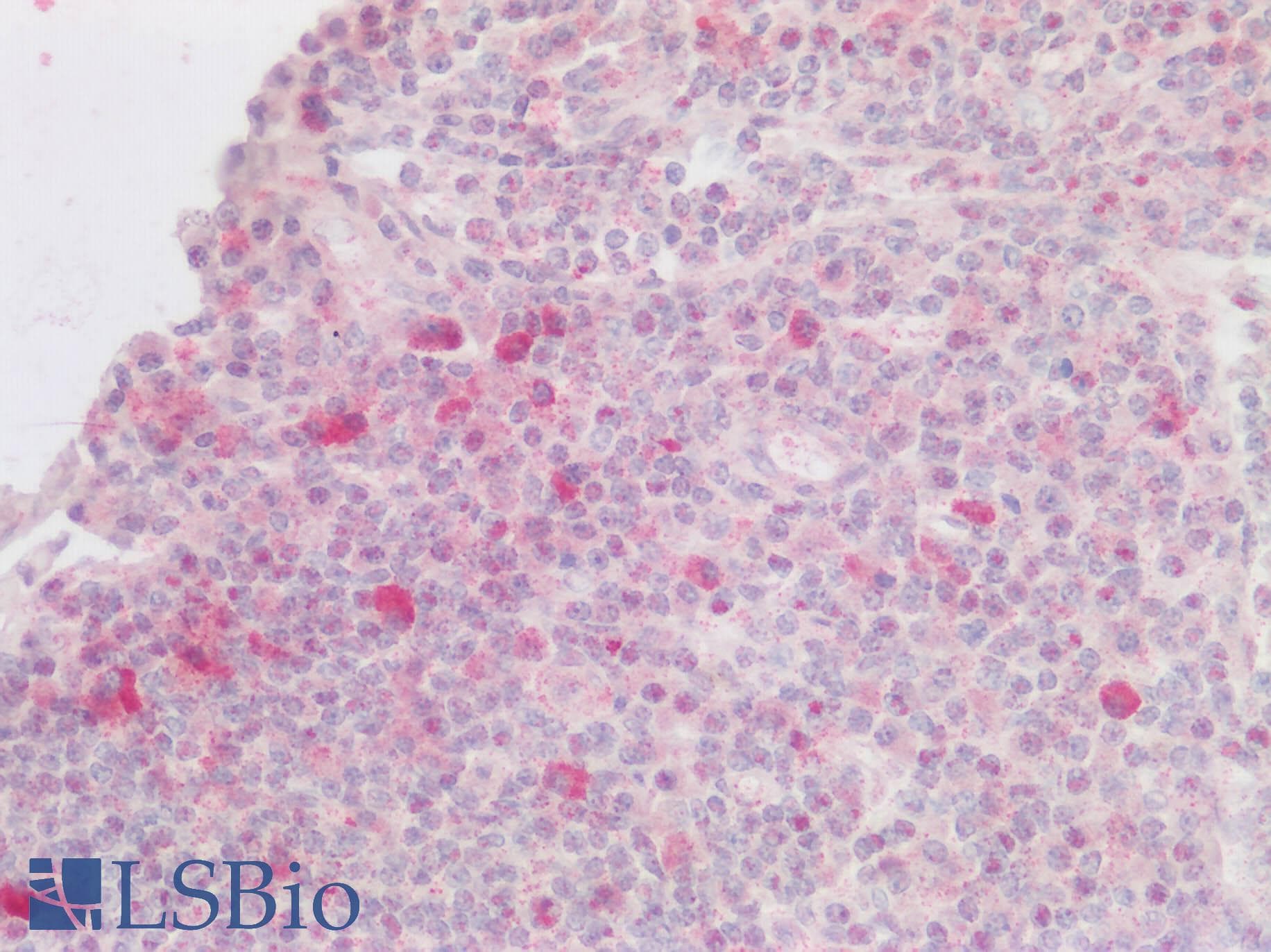 IHC-plus™ Polyclonal Rabbit anti-Human CXCR6 Antibody (Cytoplasmic Domain, IHC)