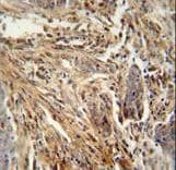 CSF2 / GM-CSF Antibody (aa59-85)