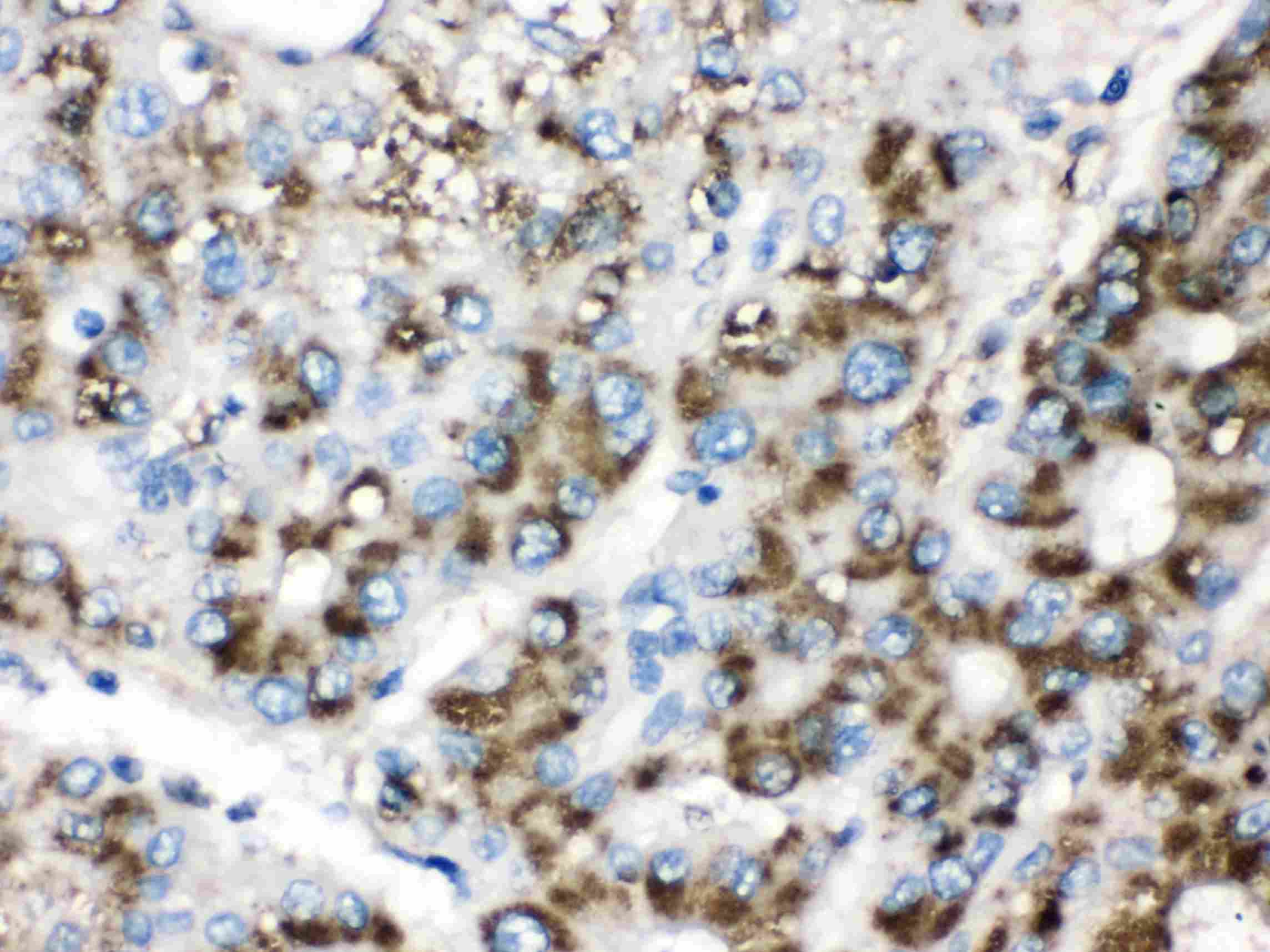 CAT / Catalase Antibody