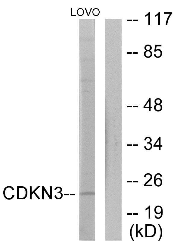 Polyclonal Rabbit anti-Human CDKN3 / KAP Antibody (WB)