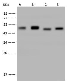 Monoclonal Mouse anti-Human ENO2 / NSE Antibody (clone 14, Preservative Free, IHC, WB)