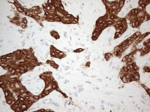 KCTD9 Antibody (aa1-223, clone OTI1D10)