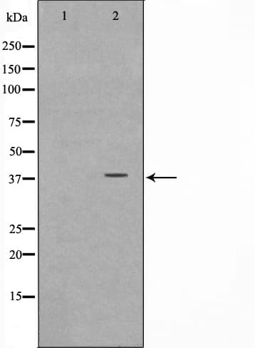 Polyclonal Rabbit anti-Human NT5C3A Antibody (IHC, IF, WB)