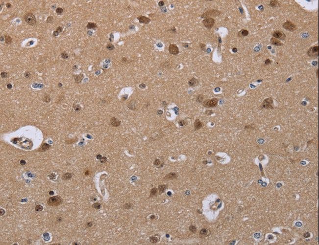 CDK5 Antibody