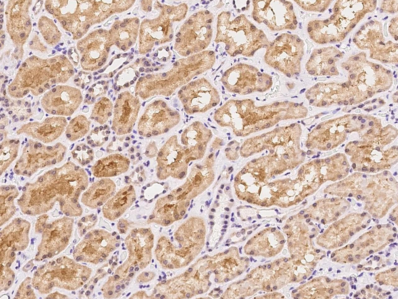 NT5C3A Antibody