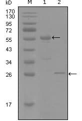 PR / Progesterone Receptor Antibody (clone 8A11H1)