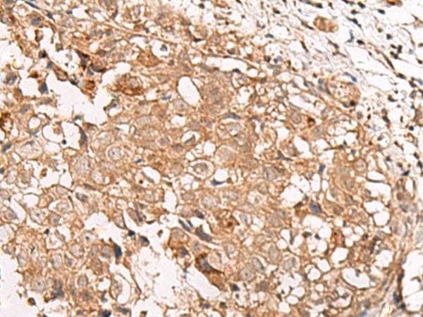 GBGT1 Antibody