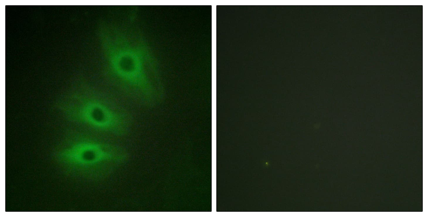 Polyclonal Rabbit anti-Human ADCY5+6 Antibody (aa931-980, IHC, IF)