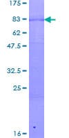 Human PATZ1 / PATZ Protein (Recombinant GST)