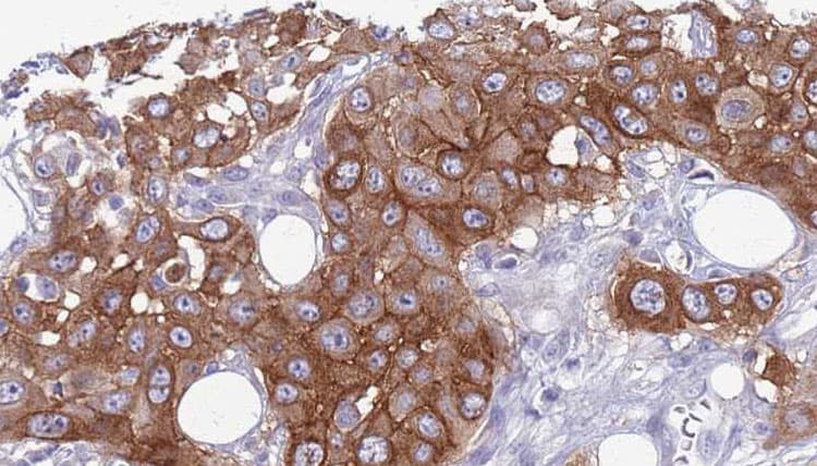 IL11RA Antibody (aa337-364)