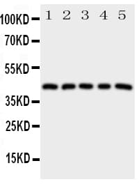 PTGER1 / EP1 Antibody (aa387-404)