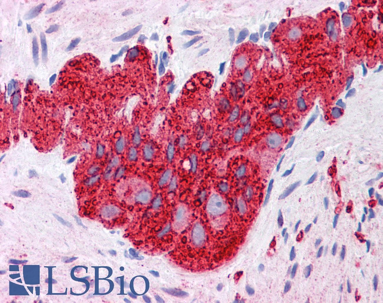 IHC-plus™ TUBB2B / Tubulin Beta 2B Antibody (clone AT5B3)