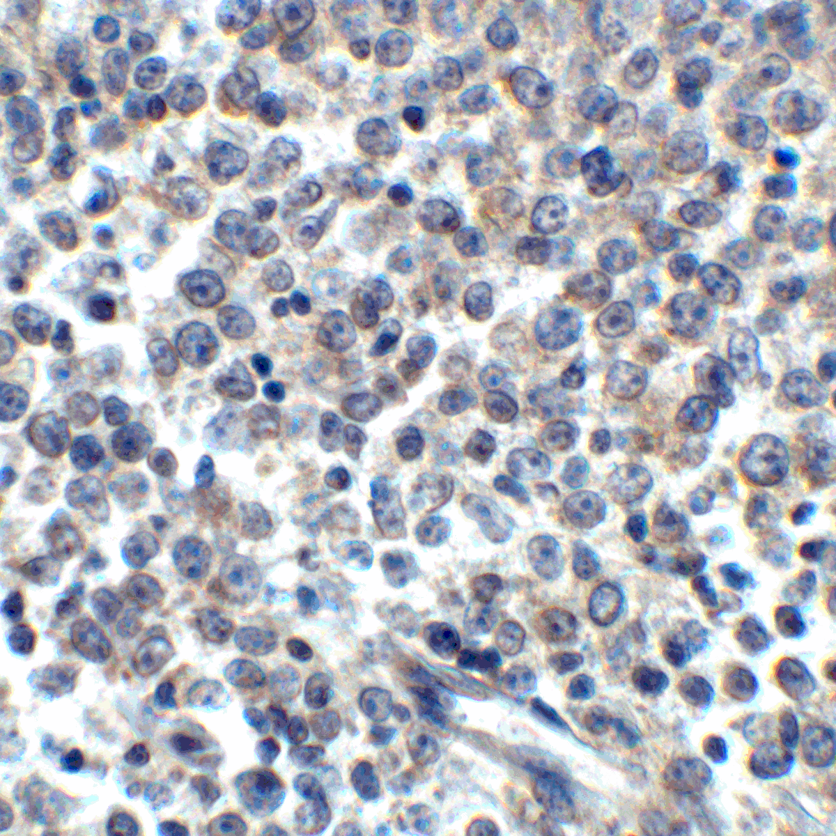 Monoclonal Mouse anti-Human TNFSF14 / LIGHT Antibody (clone 7B9H9, IHC, IF, WB)