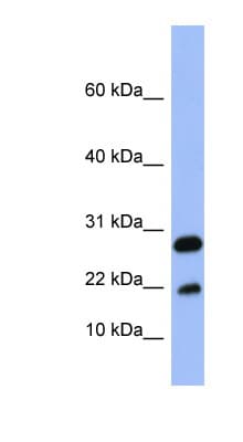 Polyclonal Rabbit anti-Human FABP4 / AP2 Antibody (aa71-120, WB)