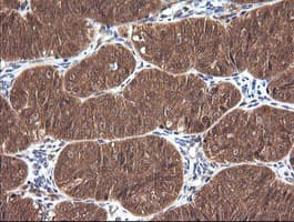 CTAG1B / NY-ESO-1 Antibody (clone OTI5B2)